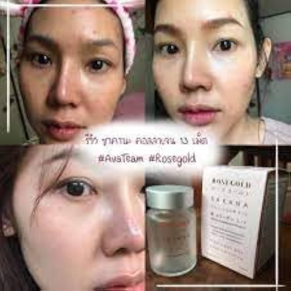 Amazon.com: Rosegold SAKANA Collagen x 10 : Health & Household